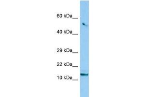 Image no. 1 for anti-Chromosome 8 Open Reading Frame 4 (C8orf4) (N-Term) antibody (ABIN2790028)