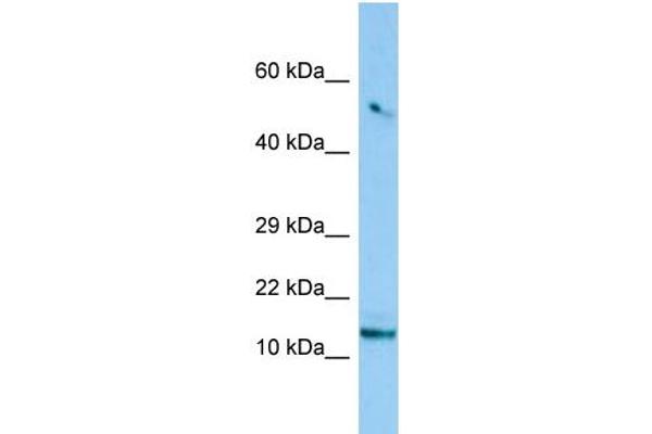 anti-Chromosome 8 Open Reading Frame 4 (C8orf4) (N-Term) antibody