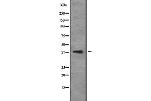 Image no. 1 for anti-Neurogenic Differentiation 6 (NEUROD6) antibody (ABIN6257385)