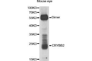 Image no. 1 for anti-Crystallin, beta B2 (CRYbB2) antibody (ABIN1876777)