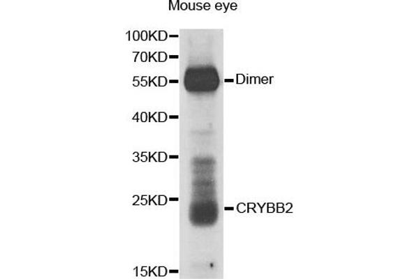 CRYbB2 antibody