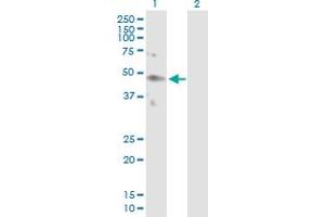 Image no. 1 for anti-Killer Cell Immunoglobulin-Like Receptor, Two Domains, Long Cytoplasmic Tail, 4 (KIR2DL4) (AA 1-377) antibody (ABIN517337)