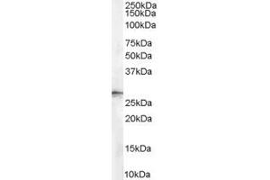 Image no. 1 for anti-Stratifin (SFN) (Internal Region) antibody (ABIN185539)