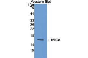 Image no. 1 for anti-Fatty Acid Binding Protein 5 (Psoriasis-Associated) (FABP5) (AA 1-135) antibody (ABIN1078020)