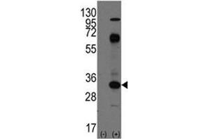 Image no. 3 for anti-CD8a Molecule (CD8A) (AA 150-180) antibody (ABIN3030431)