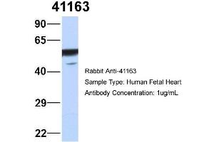 Image no. 3 for anti-Septin 11 (SEPT11) (N-Term) antibody (ABIN2787099)