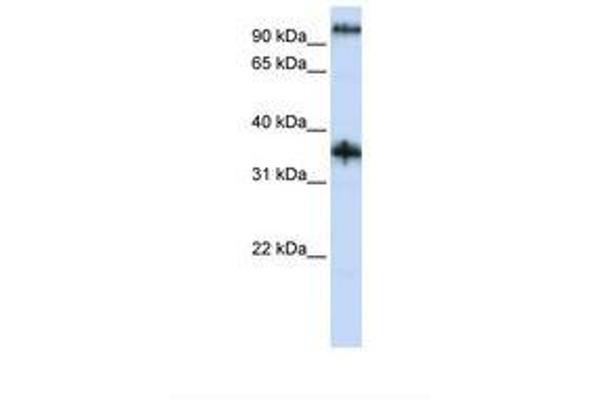 Ferric-Chelate Reductase 1 Like (FRRS1L) (AA 74-123) antibody