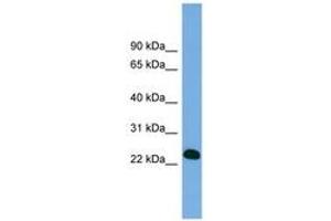 Image no. 1 for anti-B-Cell CLL/lymphoma 7A (BCL7A) (AA 71-120) antibody (ABIN6743279)