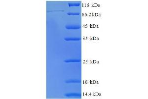 Image no. 1 for Polymerase (RNA) III (DNA Directed) Polypeptide C (62kD) (POLR3C) (AA 1-534), (full length) protein (His-SUMO Tag) (ABIN5711825)
