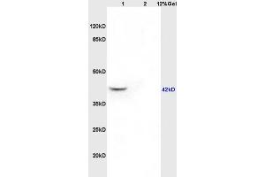 Image no. 1 for anti-Guanine Nucleotide Binding Protein (G Protein), Q Polypeptide (GNAQ) (AA 51-150) antibody (ABIN763181)