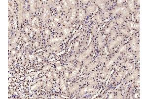 Image no. 6 for anti-Acidic (Leucine-Rich) Nuclear phosphoprotein 32 Family, Member A (ANP32A) (AA 70-120) antibody (ABIN762176)