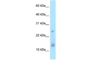 Image no. 1 for anti-Dynein, Light Chain, LC8-Type 1 (DYNLL1) (Middle Region) antibody (ABIN2784486)