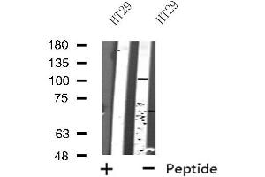 Image no. 1 for anti-SP100 Nuclear Antigen (SP100) (Internal Region) antibody (ABIN6257499)
