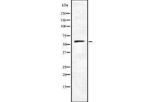 Image no. 1 for anti-Caspase Recruitment Domain Family, Member 9 (CARD9) antibody (ABIN6260462)