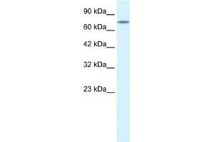 Image no. 1 for anti-Receptor (TNFRSF)-Interacting serine-threonine Kinase 1 (RIPK1) (Middle Region) antibody (ABIN2792131)