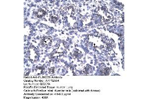 Image no. 3 for anti-Forkhead Box P1 (FOXP1) (N-Term) antibody (ABIN2779725)