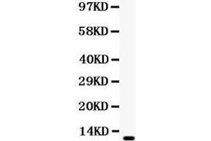 Image no. 1 for anti-Chemokine (C-C Motif) Ligand 5 (CCL5) (AA 26-91) antibody (ABIN3043478)