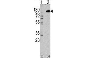 Image no. 3 for anti-Fibroblast Growth Factor Receptor 2 (FGFR2) (AA 794-821) antibody (ABIN3030952)