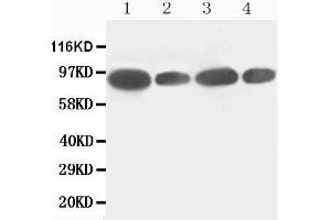 Image no. 1 for anti-Feline Sarcoma Oncogene (FES) (AA 808-822), (C-Term) antibody (ABIN3043015)