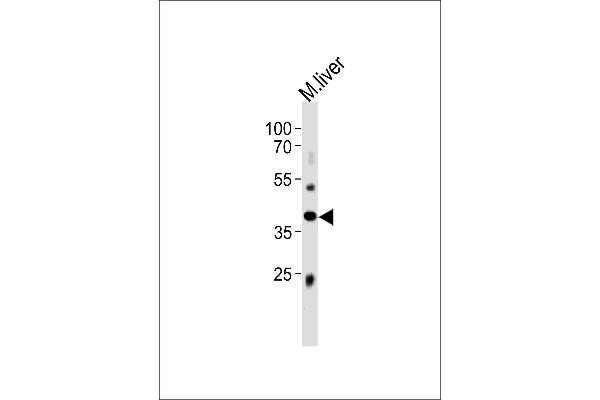 anti-ABI Family, Member 3 (ABI3) (AA 300-329), (C-Term) antibody