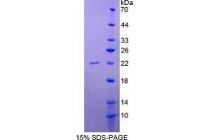 Image no. 1 for BCL2-Associated Agonist of Cell Death (BAD) (AA 1-168) protein (His tag) (ABIN6238007)