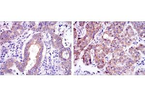 Image no. 4 for anti-REL proto-oncogene (c-Rel) antibody (ABIN968997)