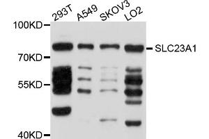 Image no. 2 for anti-Sodium Dependent Vitamin C Transporter 1 (SVCT1) antibody (ABIN4905185)