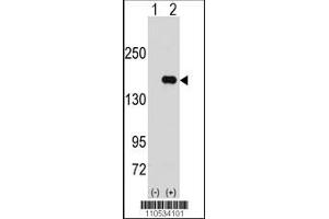Image no. 1 for anti-Pumilio Homolog 2 (Drosophila) (PUM2) (AA 133-162), (N-Term) antibody (ABIN391821)