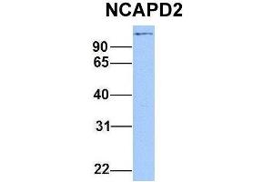 Image no. 2 for anti-Non-SMC Condensin I Complex, Subunit D2 (NCAPD2) (C-Term) antibody (ABIN2782540)