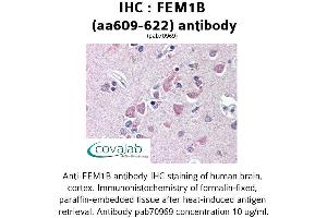Image no. 1 for anti-Fem-1 Homolog B (FEM1B) (AA 609-622) antibody (ABIN1734320)