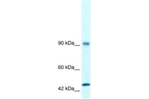 Image no. 1 for anti-RNA Binding Motif Protein 10 (RBM10) antibody (ABIN2460169)