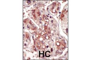 Image no. 4 for anti-Mitogen-Activated Protein Kinase Kinase 2 (MAP2K2) (Center) antibody (ABIN2448074)