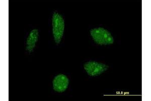 Image no. 1 for anti-KH-Type Splicing Regulatory Protein (KHSRP) (AA 151-239) antibody (ABIN522037)