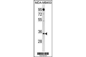 Image no. 1 for anti-Methylthioadenosine phosphorylase (MTAP) (AA 8-37), (N-Term) antibody (ABIN1881557)