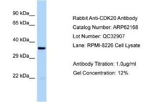 Image no. 1 for anti-Cyclin-Dependent Kinase 20 (CDK20) (Middle Region) antibody (ABIN2789045)