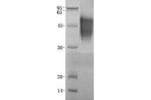 Image no. 1 for Neuroplastin (NPTN) (Transcript Variant C) protein (ABIN2727195)