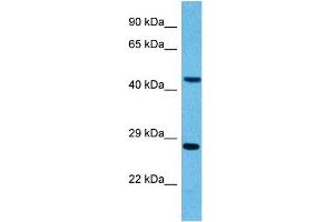Image no. 2 for anti-Pygopus Homolog 2 (PYGO2) (N-Term) antibody (ABIN2784477)