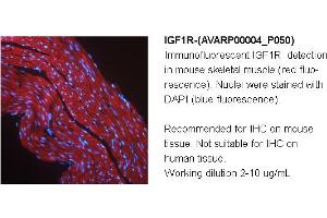 Image no. 1 for anti-Insulin-Like Growth Factor 1 Receptor (IGF1R) (Middle Region) antibody (ABIN2792087)