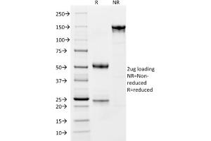 Image no. 5 for anti-CD163 (CD163) (AA 43-196) antibody (ABIN6941114)