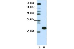 Image no. 1 for anti-Ribosomal Protein L13 (RPL13) (C-Term) antibody (ABIN633465)