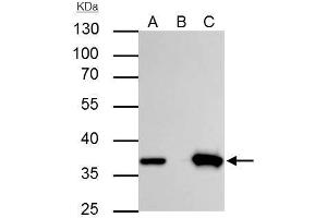Image no. 5 for anti-Thymidylate Synthetase (TYMS) (Center) antibody (ABIN2855587)