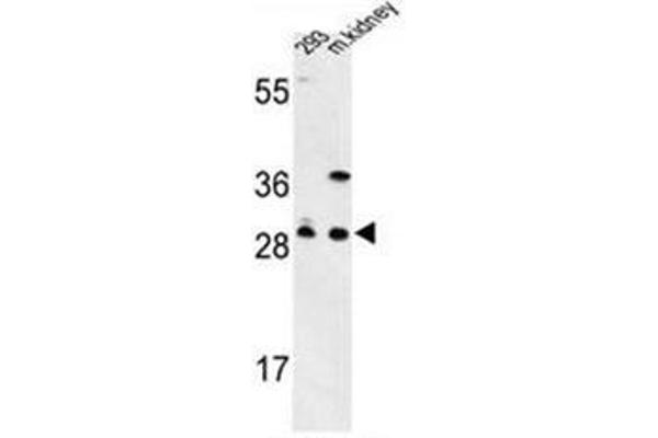 anti-Glutamate-Cysteine Ligase, Modifier Subunit (GCLM) (AA 245-274), (C-Term) antibody