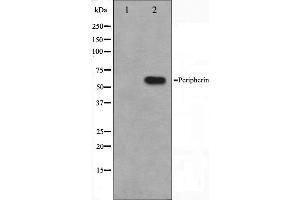 Image no. 2 for anti-Peripherin (PRPH) (C-Term) antibody (ABIN6264142)