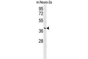 Image no. 1 for anti-Cancer Susceptibility Candidate 4 (CASC4) (AA 343-373), (C-Term) antibody (ABIN951049)