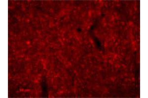 Image no. 2 for anti-Agouti Related Protein Homolog (Mouse) (AGRP) antibody (ABIN542610)