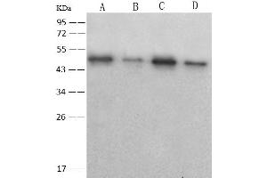 Image no. 1 for anti-SARS-Coronavirus Nucleocapsid Protein (SARS-CoV N) (AA 1-422) antibody (ABIN6923345)