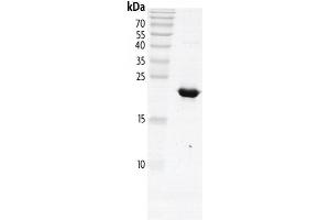 Image no. 2 for Polybromo 1 (PBRM1) (AA 613-734) protein (His tag,DYKDDDDK Tag) (ABIN2669650)