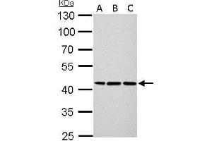 Image no. 3 for anti-Keratin 14 (KRT14) (Center) antibody (ABIN2855778)