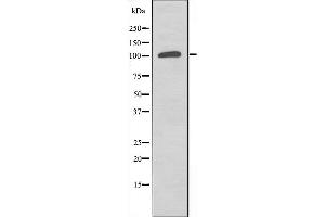 Image no. 1 for anti-Suppression of Tumorigenicity 5 (ST5) (Internal Region) antibody (ABIN6257500)