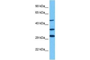 Host:  Rabbit  Target Name:  GLIS3  Sample Tissue:  Human 293T Whole Cell  Antibody Dilution:  1ug/ml